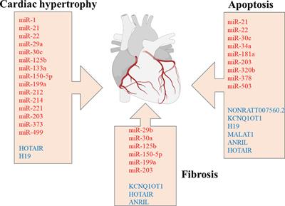 Diabetic cardiomyopathy: The role of microRNAs and long non-coding RNAs